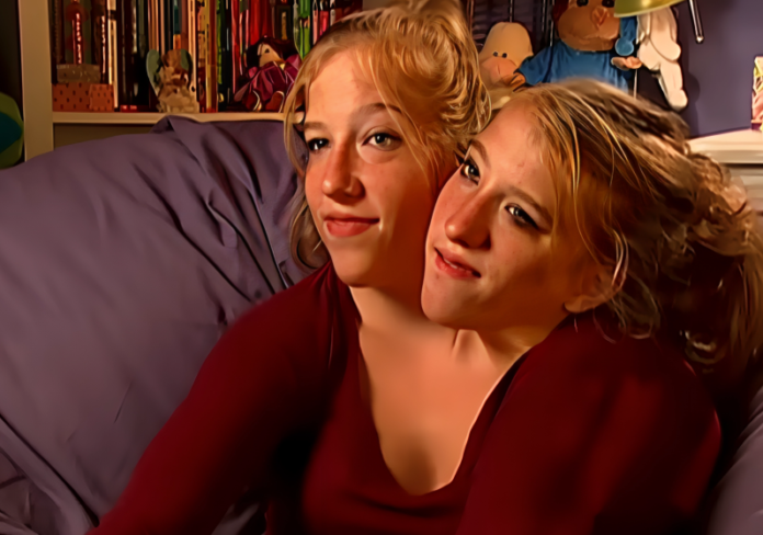 conjoined twins, Abby and Brittany Hensel, reality TV, human interest stories, medical marvels